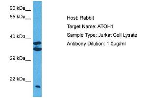 Host:  Rabbit  Target Name:  ATOH1  Sample Tissue:  Human Jurkat Whole Cell  Antibody Dilution:  1ug/ml (ATOH1 antibody  (Middle Region))
