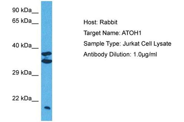 ATOH1 Antikörper  (Middle Region)