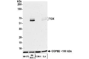 Western Blotting (WB) image for anti-Thymus High Mobility Group Box Protein (TOX) (AA 50-100) antibody (ABIN7453374)