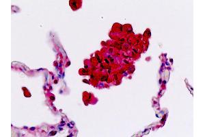 Anti-SELL / L-Selectin / CD62L antibody IHC staining of human lung, macrophages. (L-Selectin antibody  (AA 346-372))