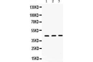 Western blot analysis of ORM1 expression in rat liver extract ( Lane 1), mouse liver extract ( Lane 2) and PANC whole cell lysates ( Lane 3).