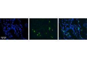 Rabbit Anti-RNASET2 Antibody     Formalin Fixed Paraffin Embedded Tissue: Human Lung Tissue  Observed Staining: Cytoplasmic in in alveolar cells, type I and II  Primary Antibody Concentration: 1:100  Other Working Concentrations: 1/600  Secondary Antibody: Donkey anti-Rabbit-Cy3  Secondary Antibody Concentration: 1:200  Magnification: 20X  Exposure Time: 0. (RNASET2 antibody  (Middle Region))