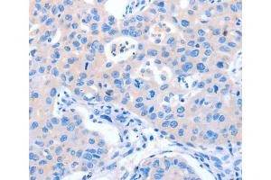 Immunohistochemistry (IHC) image for anti-NUAK Family, SNF1-Like Kinase, 1 (NUAK1) antibody (ABIN2434136) (NUAK1 antibody)