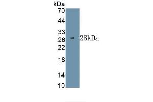 Detection of Recombinant ERK1, Human using Monoclonal Antibody to Extracellular Signal Regulated Kinase 1 (ERK1) (ERK1 antibody  (AA 75-312))