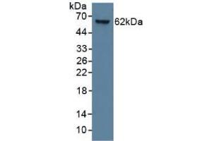 Mouse Capture antibody from the kit in WB with Positive Control: Human lung lysate. (KRT9 ELISA Kit)