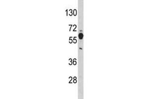 Western Blotting (WB) image for anti-phosphoglycerate Dehydrogenase (PHGDH) (AA 140-168) antibody (ABIN3032221)