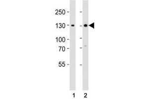 Western blot analysis of lysate from (1) 293 and (2) Jurkat cell line using GLI2 antibody at 1:1000. (GLI2 antibody  (C-Term))