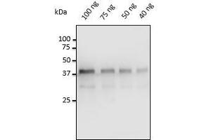 Anti-Pepsin Ab at 1/500 dilution, 40-100 ng of Pepsin isolated from porcine gastric mucosa, rabbit polyclonal to goat lgG (HRP) at 1/10,000 dilution, (Pepsin antibody)