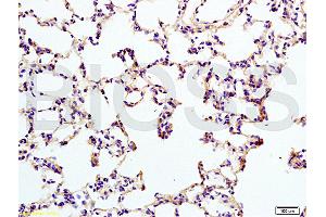 Formalin-fixed and mouse brain tissue labeled with Anti-IL12RB2 Polyclonal Antibody (ABIN747878), Unconjugated at 1:200 followed by conjugation to the secondary antibody and DAB staining (IL12RB2 antibody  (AA 301-400))