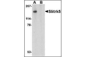Western blot analysis of Slitrk4 in mouse brain tissue lysate with this product at (A) 0.
