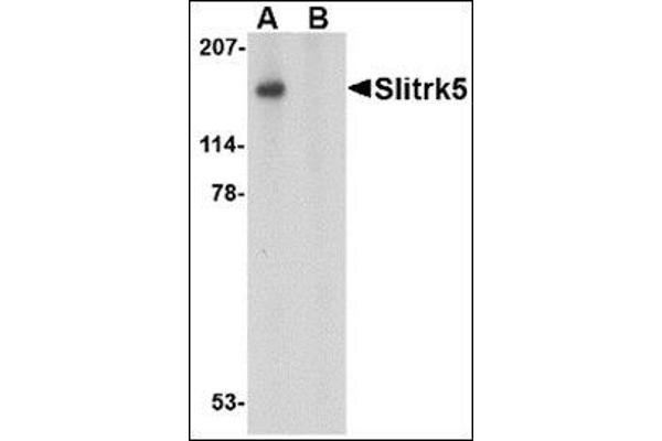 SLITRK5 抗体  (Center)