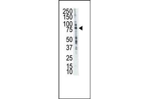 Image no. 1 for anti-Leukocyte Receptor tyrosine Kinase (LTK) (N-Term) antibody (ABIN359893) (LTK antibody  (N-Term))