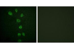 P-peptide - +Immunofluorescence analysis of HepG2 cells, using GATA4 (Phospho-Ser105) antibody. (GATA4 antibody  (pSer105))