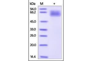 Human Serpin A3, His Tag on SDS-PAGE under reducing (R) condition. (SERPINA3 Protein (AA 24-423) (His tag))