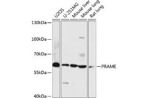Western blot analysis of extracts of various cell lines, using PRAME antibody (ABIN7269507) at 1:3000 dilution. (PRAME antibody  (AA 1-200))