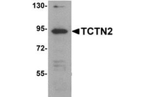 Western blot analysis of TCTN2 in SK-N-SH cell lysate with TCTN2 antibody at 1 μg/ml. (TCTN2 antibody  (C-Term))