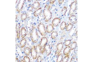 Immunohistochemistry (IHC) image for anti-Fc Fragment of IgG, High Affinity Ia, Receptor (CD64) (FCGR1A) (AA 200-292) antibody (ABIN3021695)