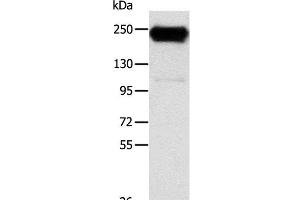 Western Blot analysis of K562 cell using RRBP1 Polyclonal Antibody at dilution of 1:400 (RRBP1 antibody)