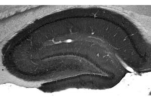 Adult rat hippocampus immunohistochemistry. (WASF1 antibody  (AA 477-498))