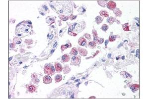 Human Lung: Formalin-Fixed, Paraffin-Embedded (FFPE) (NLRP14 antibody  (N-Term))