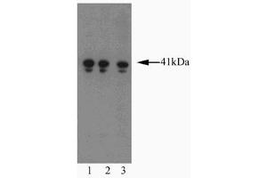 Western blot analysis of AIM-1 on a Jurkat cell lysate (Human T-cell leukemia, ATCC TIB-152). (Aurora Kinase B antibody  (AA 2-124))