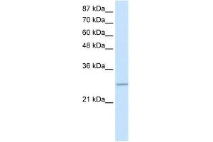 WB Suggested Anti-C20ORF20 Antibody Titration: 0. (MRGBP antibody  (Middle Region))