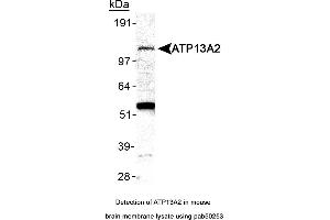 Image no. 2 for anti-ATPase Type 13A2 (ATP13A2) (AA 200-300), (Internal Region) antibody (ABIN363562)