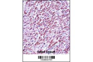 SMAD3 Antibody immunohistochemistry analysis in formalin fixed and paraffin embedded human heart tissue followed by peroxidase conjugation of the secondary antibody and DAB staining. (SMAD3 antibody  (AA 127-156))