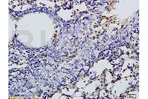 Formalin-fixed and paraffin embedded rat lung tissue labeled with Rabbit Anti-SGLT1 Polyclonal Antibody, Unconjugated (ABIN738066) 1:200 followed by conjugation to the secondary antibody and DAB staining