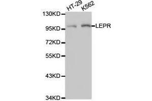 Western Blotting (WB) image for anti-Leptin Receptor (LEPR) antibody (ABIN1873534) (Leptin Receptor antibody)