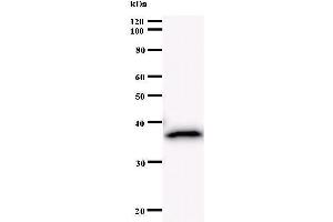 Western Blotting (WB) image for anti-BRCA1 Associated RING Domain 1 (BARD1) antibody (ABIN930988) (BARD1 antibody)