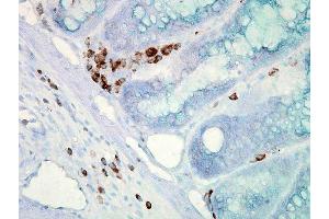 Immunohistochemistry analysis using Mouse Anti-Hsp70 Monoclonal Antibody, Clone C92 . (HSP70 antibody  (HRP))