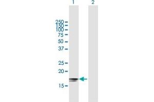 Western Blot analysis of IFNA2 expression in transfected 293T cell line by IFNA2 MaxPab polyclonal antibody. (IFNA2 antibody  (AA 1-188))