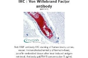 Image no. 1 for anti-Von Willebrand Factor (VWF) antibody (ABIN1740780) (VWF antibody)