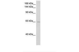 Image no. 1 for anti-Zinc Finger RNA Binding Protein (ZFR) (C-Term) antibody (ABIN6736244) (ZFR antibody  (C-Term))