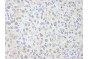 Immunohistochemistry (IHC) image for anti-SNW Domain Containing 1 (SNW1) (AA 450-500) antibody (ABIN7448684)