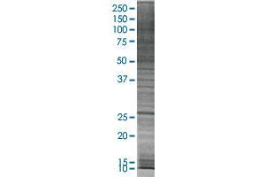 SNAP25 transfected lysate. (SNAP25 293T Cell Transient Overexpression Lysate(Denatured))