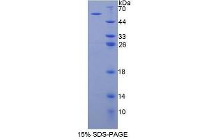SDS-PAGE (SDS) image for Myosin IC (MYO1C) (AA 765-1011) protein (His tag,GST tag) (ABIN1878611)