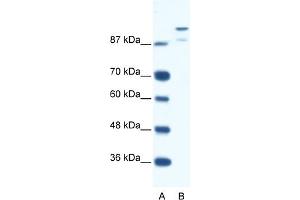 WB Suggested Anti-HKR1 Antibody Titration:  0. (HKR1 antibody  (N-Term))