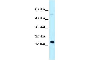 WB Suggested Anti-1110059E24Rik Antibody Titration: 1. (1110059E24Rik antibody  (N-Term))