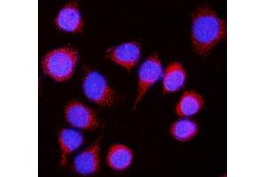 IF analysis of Nicastrin/NCSTN using anti-Nicastrin/NCSTN antibody (ABIN7601402). (Nicastrin antibody  (AA 34-669))