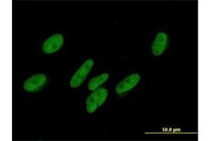 Immunofluorescence of purified MaxPab antibody to ZNF777 on HepG2 cell. (ZNF777 antibody  (AA 1-518))