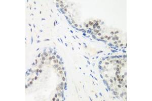 Immunohistochemistry of paraffin-embedded human prostate using PPAN antibody (ABIN6133157, ABIN6145994, ABIN6145996 and ABIN6223238) at dilution of 1:200 (40x lens). (PPAN antibody  (AA 1-300))