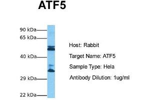 Host: Rabbit Target Name: ATF5 Sample Tissue: Human Hela Antibody Dilution: 1. (ATF5 antibody  (N-Term))