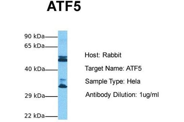 ATF5 抗体  (N-Term)