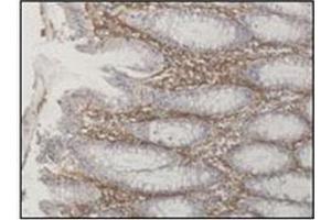 Paraformaldehyde-fixed paraffin-embedded biopsy from patient with confirmed colonic Crohn disease. (ATG16L1 antibody  (AA 84-114))