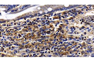 Detection of TLR5 in Rat Small intestine Tissue using Polyclonal Antibody to Toll Like Receptor 5 (TLR5) (TLR5 antibody  (AA 325-644))