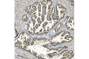 IHC analysis of Rex1/ZFP42 using anti-Rex1/ZFP42 antibody (ABIN7600901). (ZFP42 antibody  (AA 25-310))