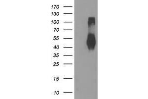 Western Blotting (WB) image for anti-Transmembrane Protein with EGF-Like and Two Follistatin-Like Domains 2 (TMEFF2) antibody (ABIN1501416) (TMEFF2 antibody)