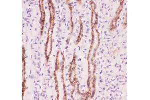 Anti-SLC9A1 Picoband antibody,  IHC(P): Mouse Kidney Tissue (SLC9A1 antibody  (AA 543-815))